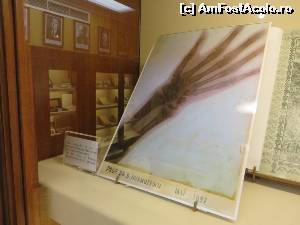 [P27] Prima radiografie cu Raxe X din România (1897).  » foto by tata123 🔱
 - 
<span class="allrVoted glyphicon glyphicon-heart hidden" id="av672984"></span>
<a class="m-l-10 hidden" id="sv672984" onclick="voting_Foto_DelVot(,672984,27230)" role="button">șterge vot <span class="glyphicon glyphicon-remove"></span></a>
<a id="v9672984" class=" c-red"  onclick="voting_Foto_SetVot(672984)" role="button"><span class="glyphicon glyphicon-heart-empty"></span> <b>LIKE</b> = Votează poza</a> <img class="hidden"  id="f672984W9" src="/imagini/loader.gif" border="0" /><span class="AjErrMes hidden" id="e672984ErM"></span>